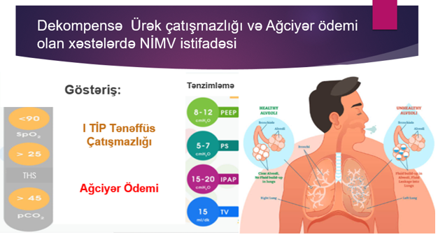 NIMV4