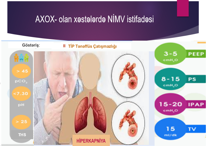 NIMV5